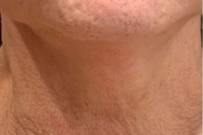 Before image of potenza