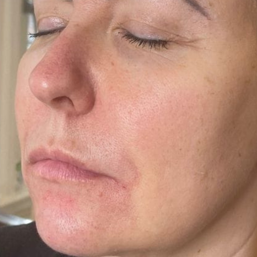 After image of Charlotte's work