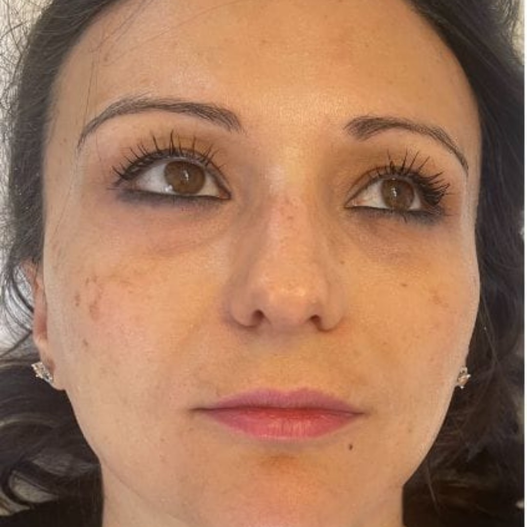 Before image of Charlotte's work