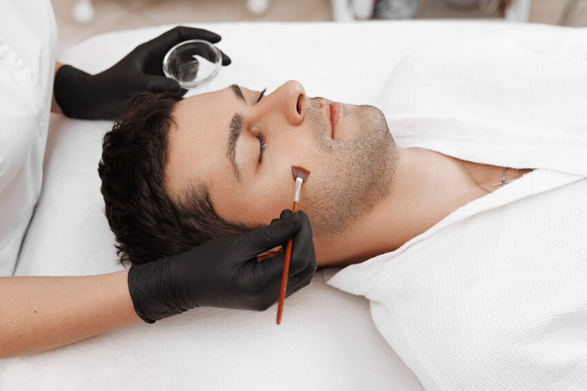 Man getting a peel applied to his face