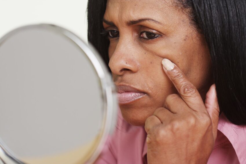 A woman looking at her wrinkles in a mirror